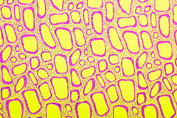 Pattern/Abstract Hologram (Neon Lime/Fuchsia)